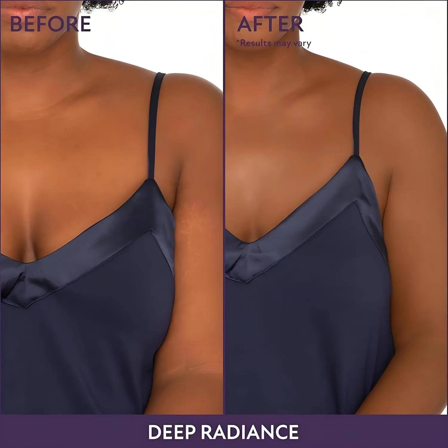 Body Coverage Perfector – Waterproof, Lightweight & Flawless Body Makeup, Body Scar Cover up for Tattoo Concealer, Easy Application, Radiant Glow, Evens Skin Tone (Golden, Body Brush)