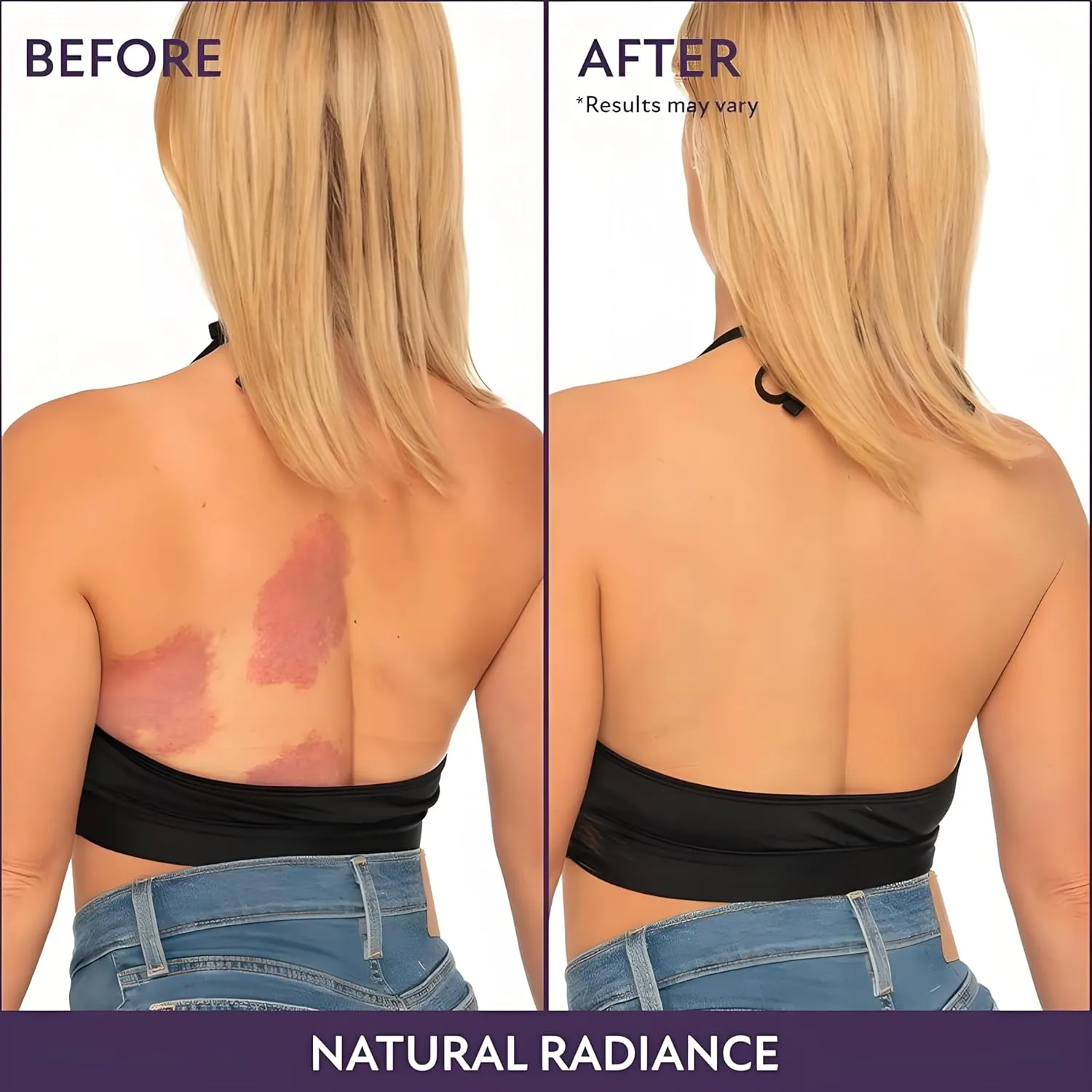 Body Coverage Perfector – Waterproof, Lightweight & Flawless Body Makeup, Body Scar Cover up for Tattoo Concealer, Easy Application, Radiant Glow, Evens Skin Tone (Golden, Body Brush)