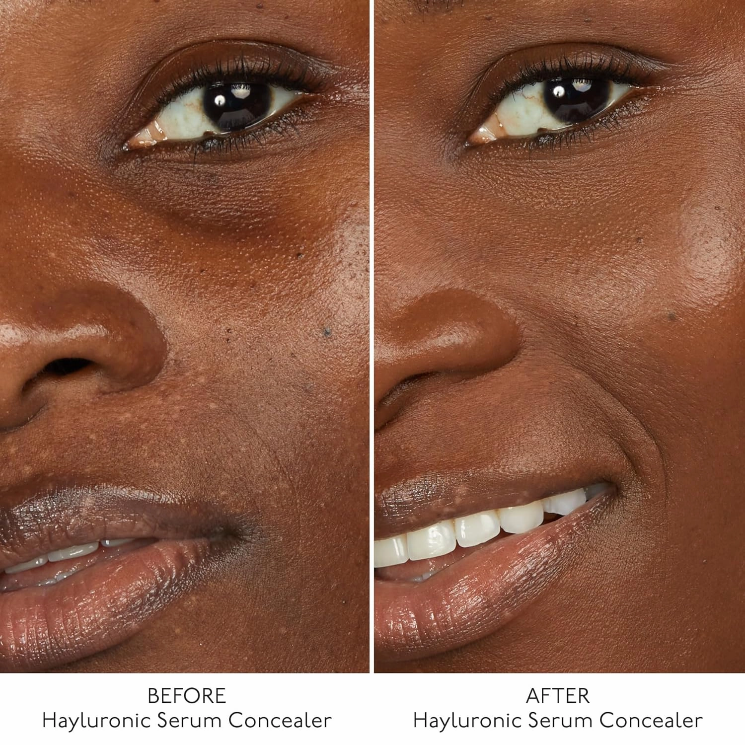 By Terry Hyaluronic Serum Concealer, Radiant & Hydrating Skincare-Infused Concealer, Buildable Coverage, Vegan, Neutral Deep