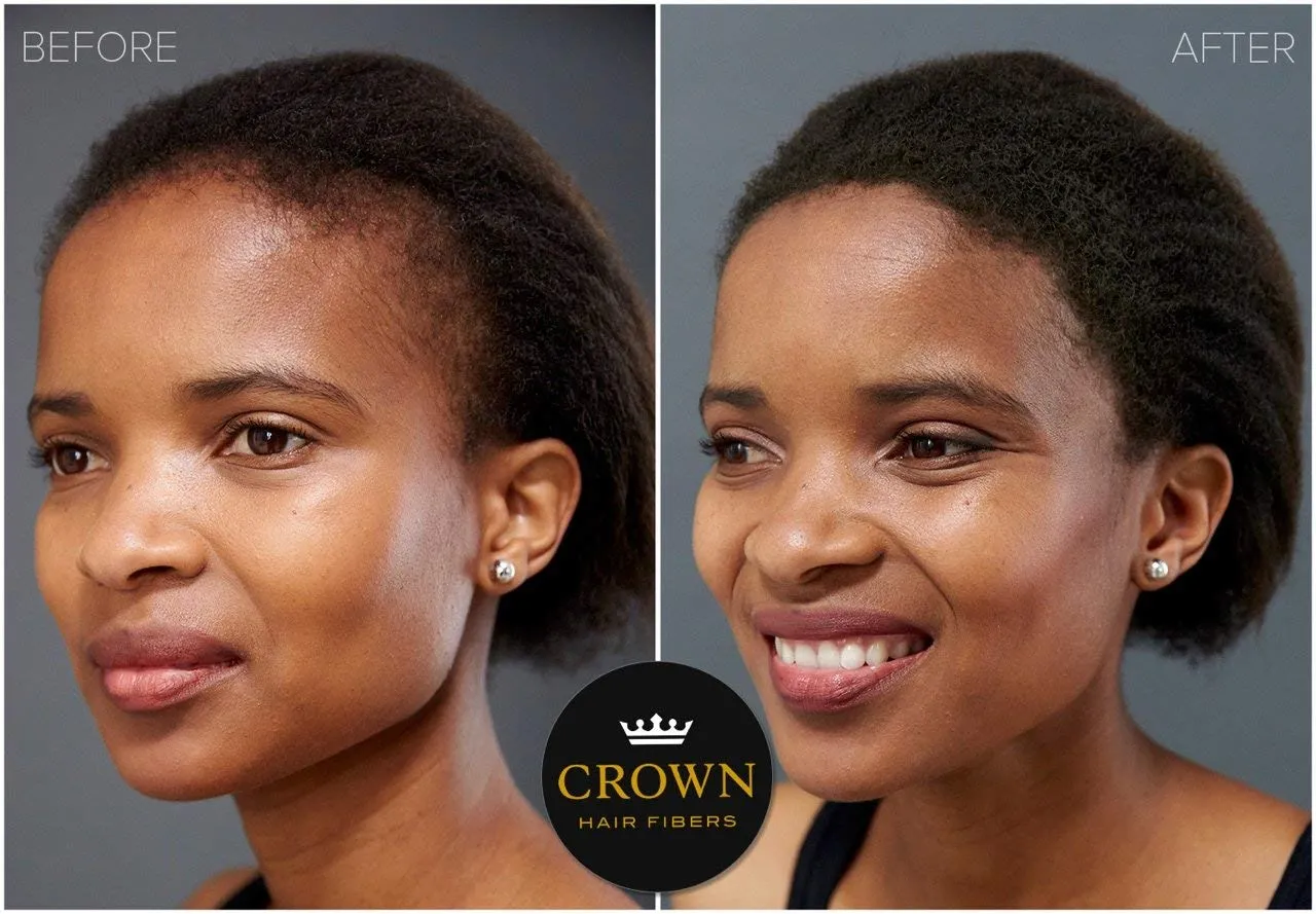 CROWN Hair Building Fibers (28g) - Instantly Cover Fine & Thinning Hair for a Thicker, Fuller Look - A Natural Keratin Concealer - 13 Shades for Men & Women - Dark Brown