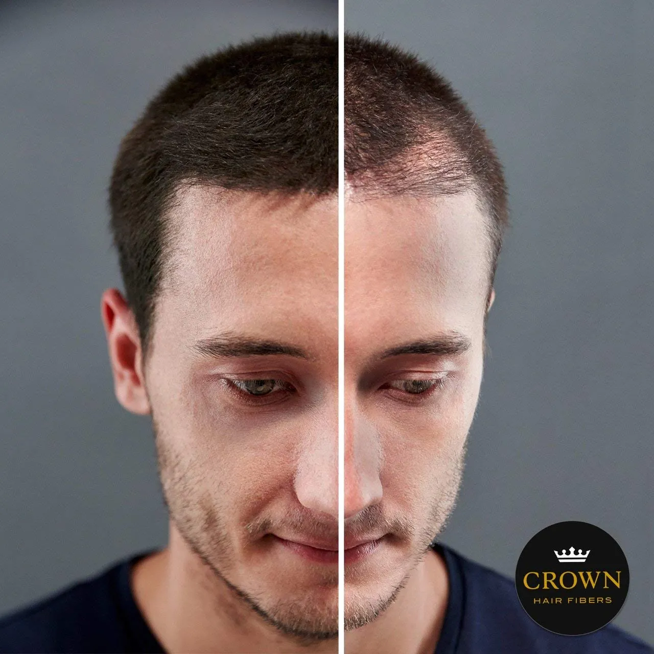 CROWN Hair Building Fibers (28g) - Instantly Cover Fine & Thinning Hair for a Thicker, Fuller Look - A Natural Keratin Concealer - 13 Shades for Men & Women - Dark Brown