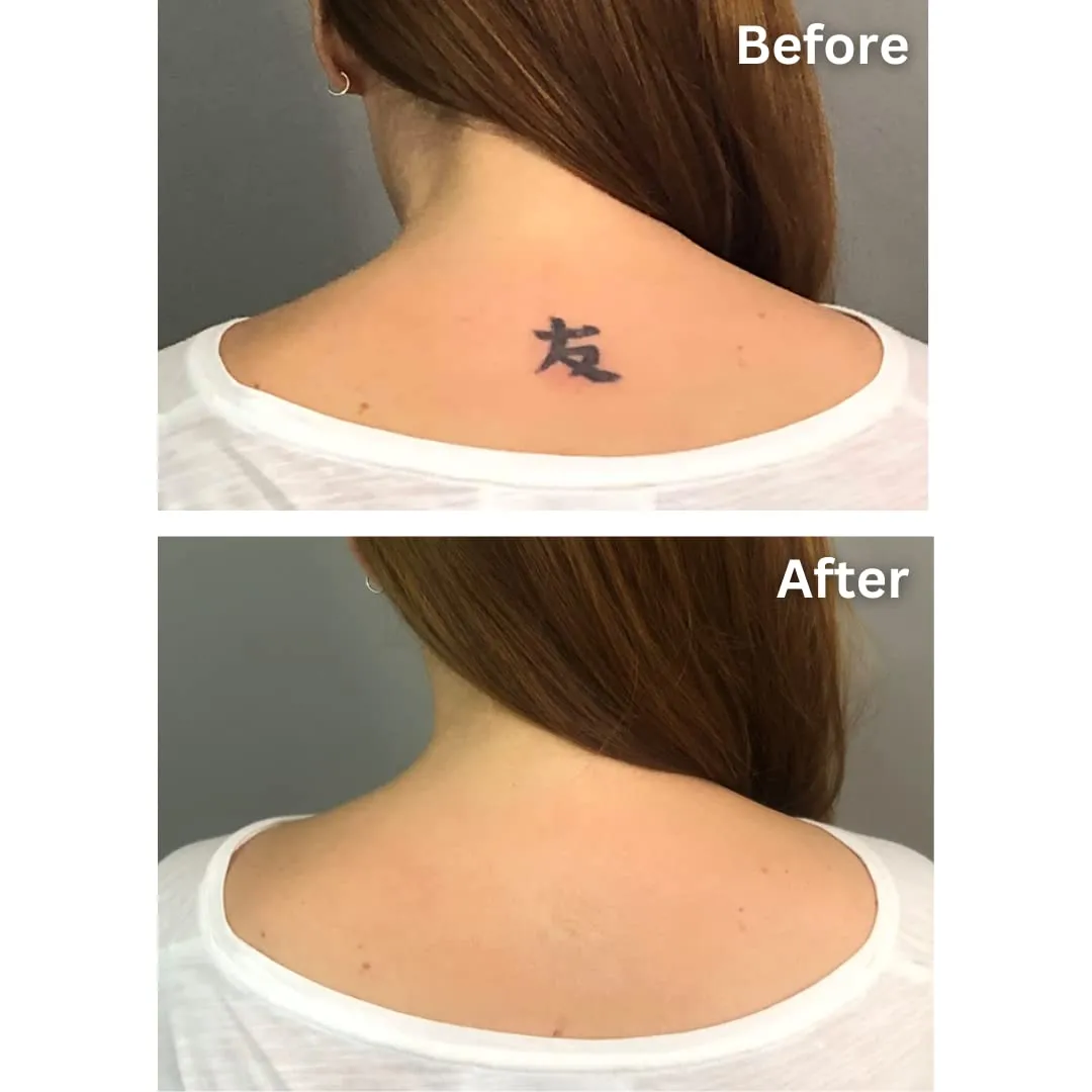 Dermaflage Tattoo Cover Up Makeup (Light Tan) - Bruise Full Coverage Concealer - Full Coverage Waterproof Concealer for Bruise,Scar & Acne - Smudge Proof Body Makeup Palette with 3Pro SFX Shades Brush