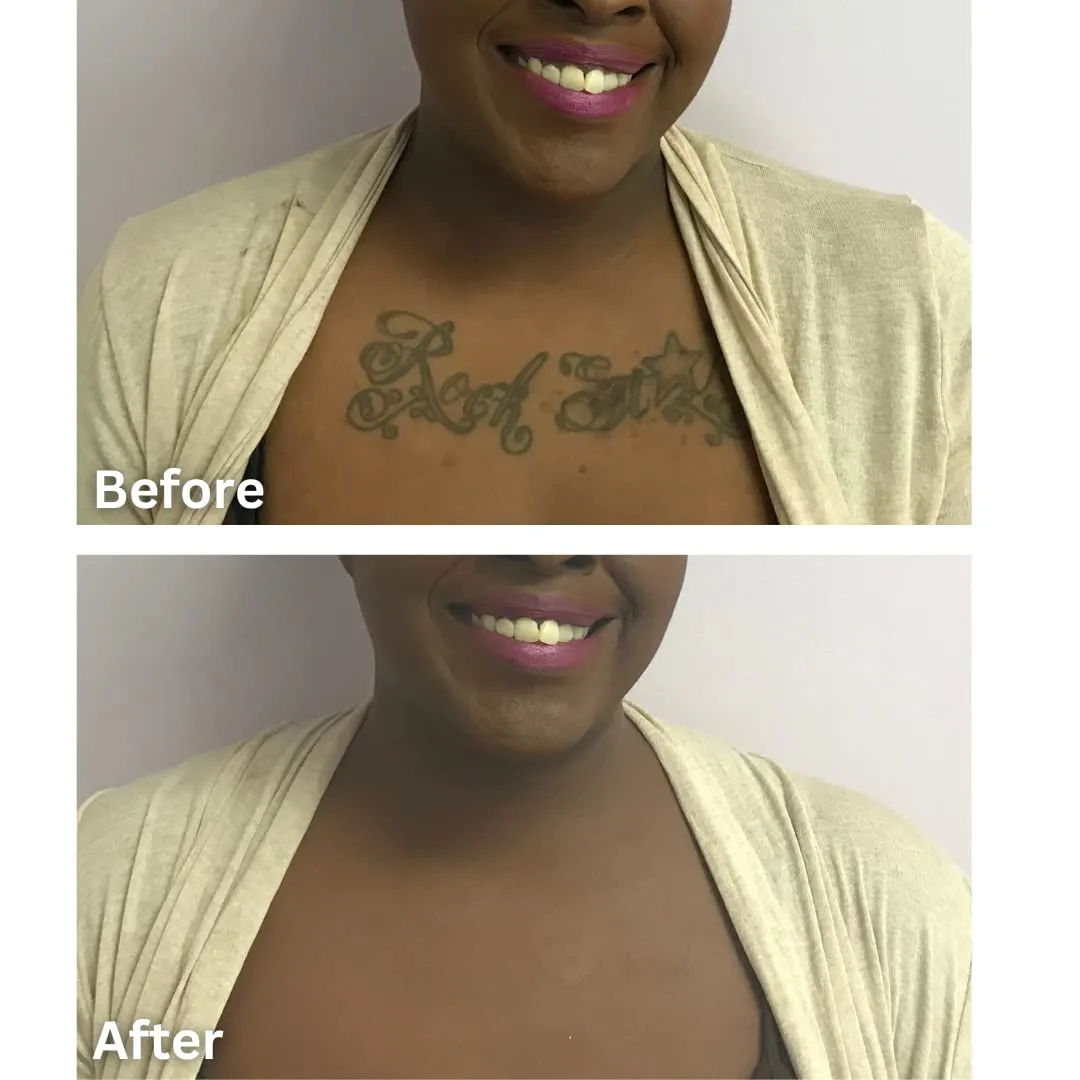 Dermaflage Tattoo Cover Up Makeup (Light Tan) - Bruise Full Coverage Concealer - Full Coverage Waterproof Concealer for Bruise,Scar & Acne - Smudge Proof Body Makeup Palette with 3Pro SFX Shades Brush