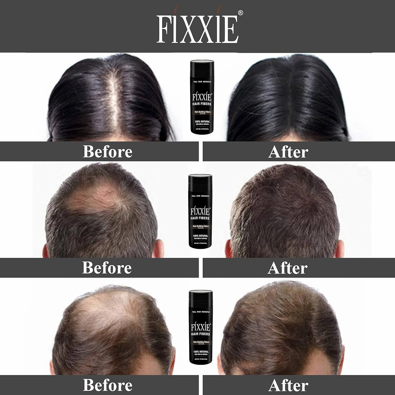 FIXXIE Hair Fibers Dark Blonde for Thinning Hair 27.5g Bottle, Concealer for Hair Loss, Men and Women, Naturally Thicker Looking With Keratin Fibres
