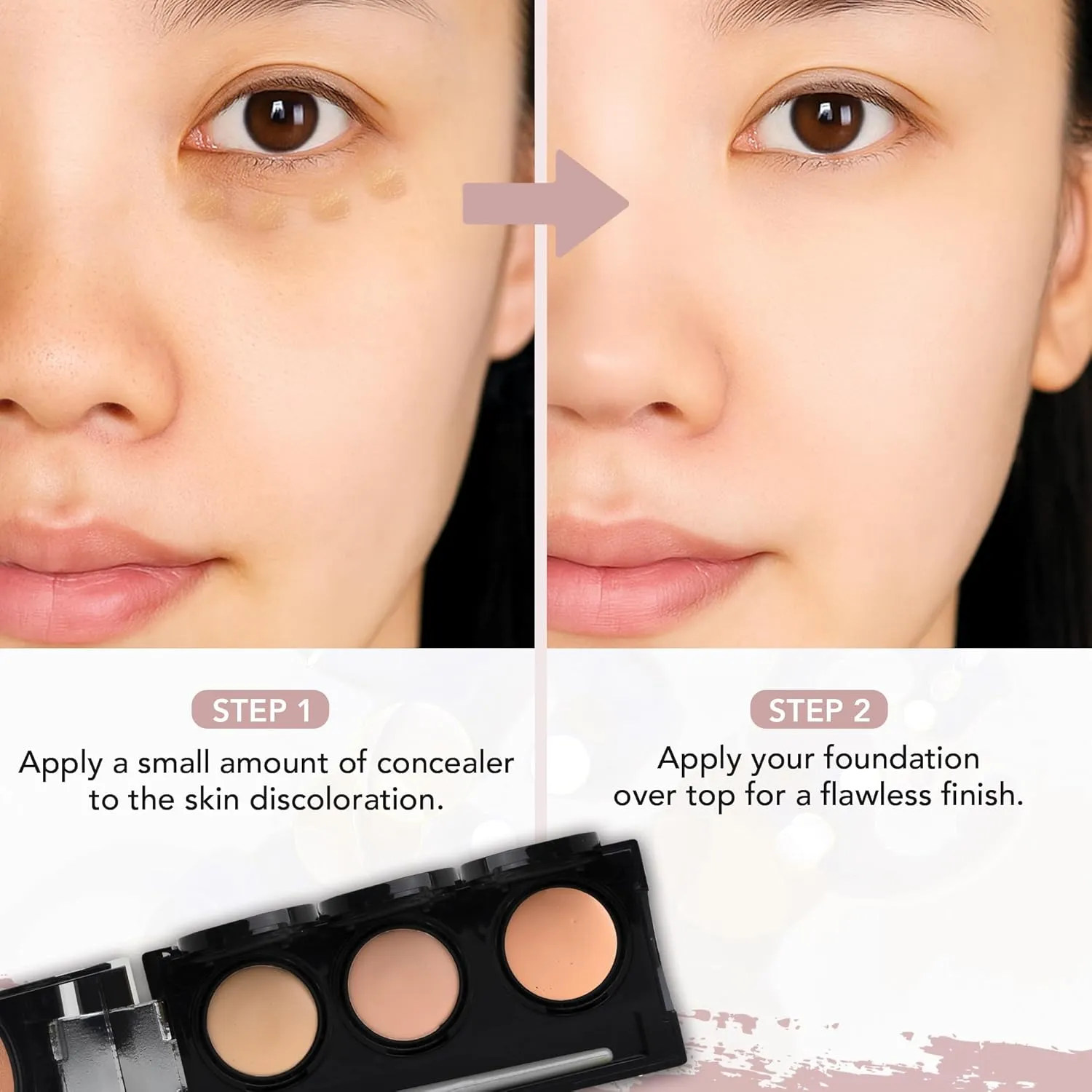 Full Coverage Concealer Palette, Waterproof Concealer Cream, 3 Colors   Brush, by Dermaflage