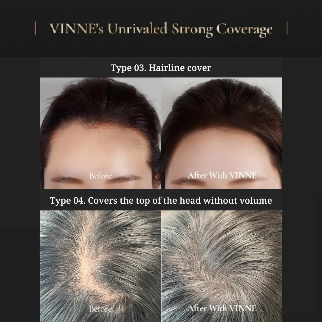 Vinne 2-Color Hair Cushion Stick: Waterproof Gray Cover, Hair Concealer, Long-Lasting Root Filler & Nutrient-Rich Care (Natural Black, Dark Brown)